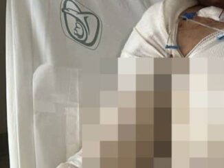 Mujer sobrevive a brutal ataque e incendio; su agresor sigue prófugo