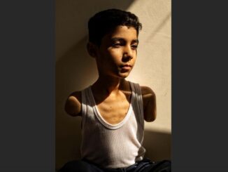 Una imagen sobre las secuelas de la guerra en niños gazatíes gana el World Press Photo