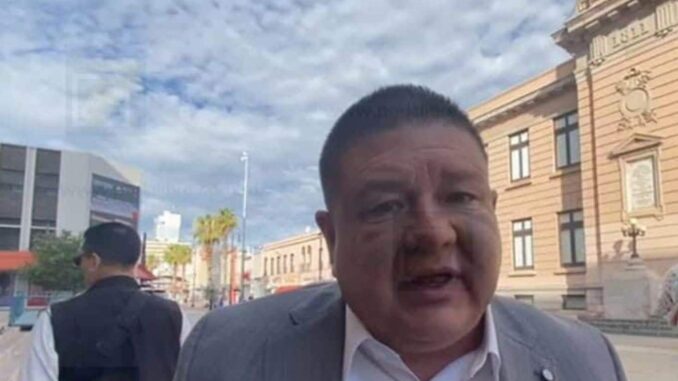 «Topón» de grupos armados en Nonoava terminó con la muerte del líder del grupo criminal “Los Tigres”: Fiscal