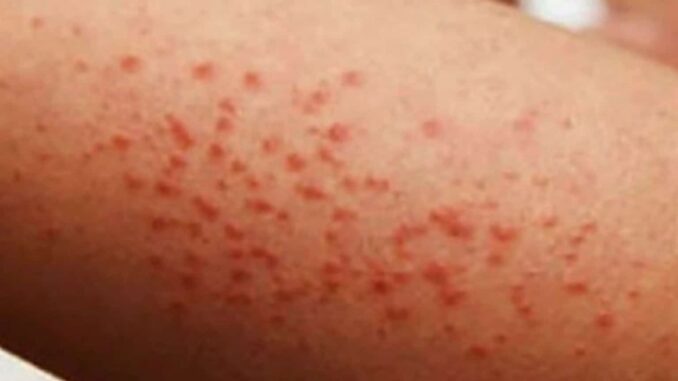 ¿cuántos casos y defunciones suman?