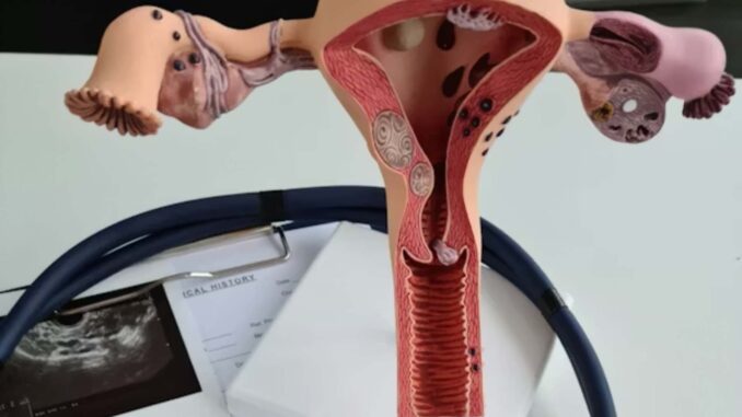 Asociación mexicana pide priorizar la atención del cáncer de ovario